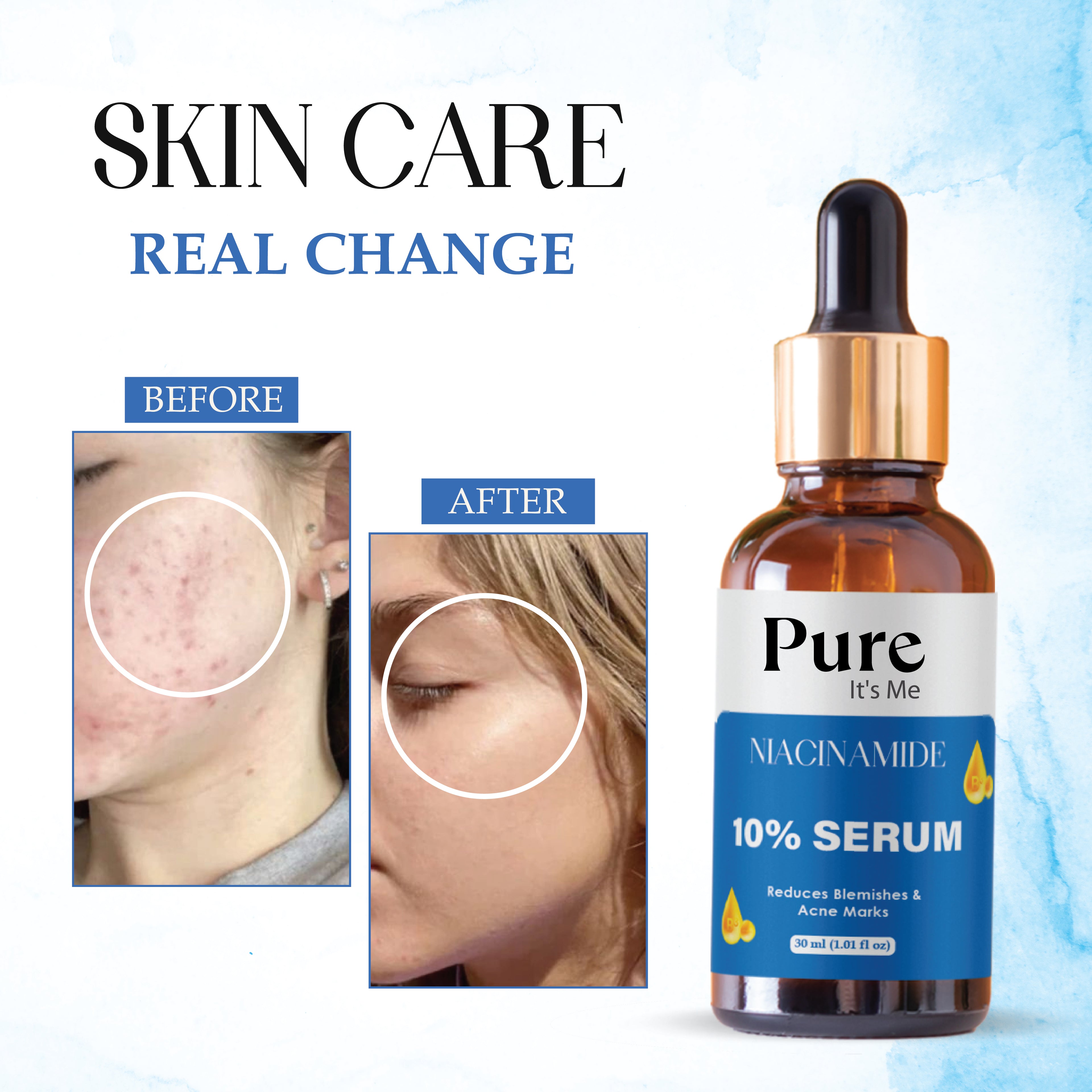 PUREITSME NIACINAMIDE FACE SERUM