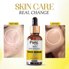 PUREITS SKIN BRIGHTENING