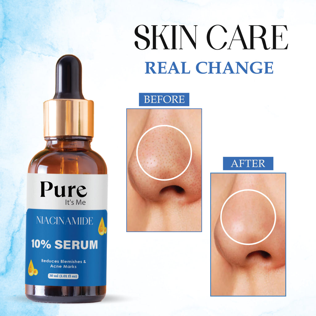 PUREITSME NIACINAMIDE FACE SERUM