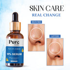 PUREITSME NIACINAMIDE FACE SERUM