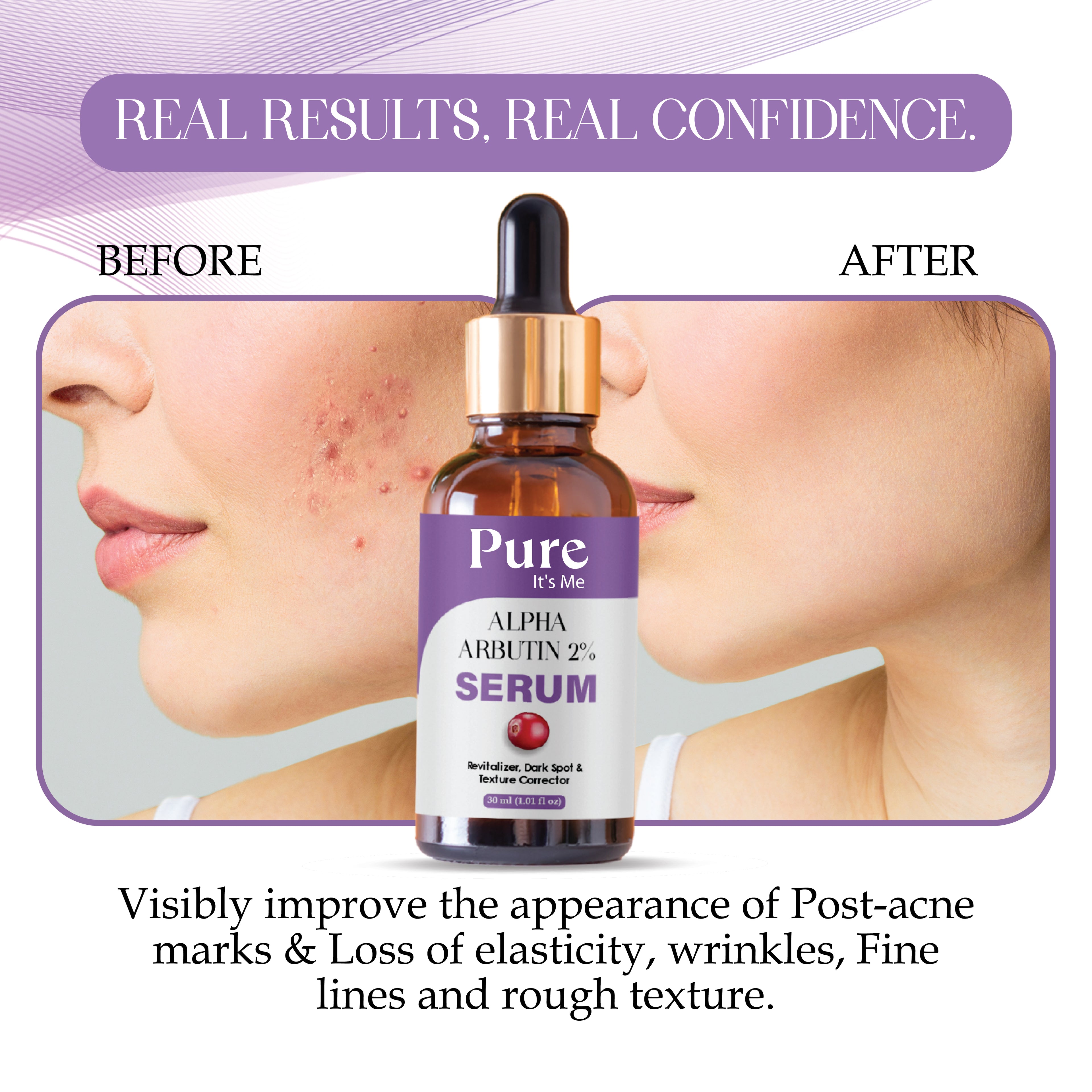 ALPHA ARBUTIN FACE SERUM