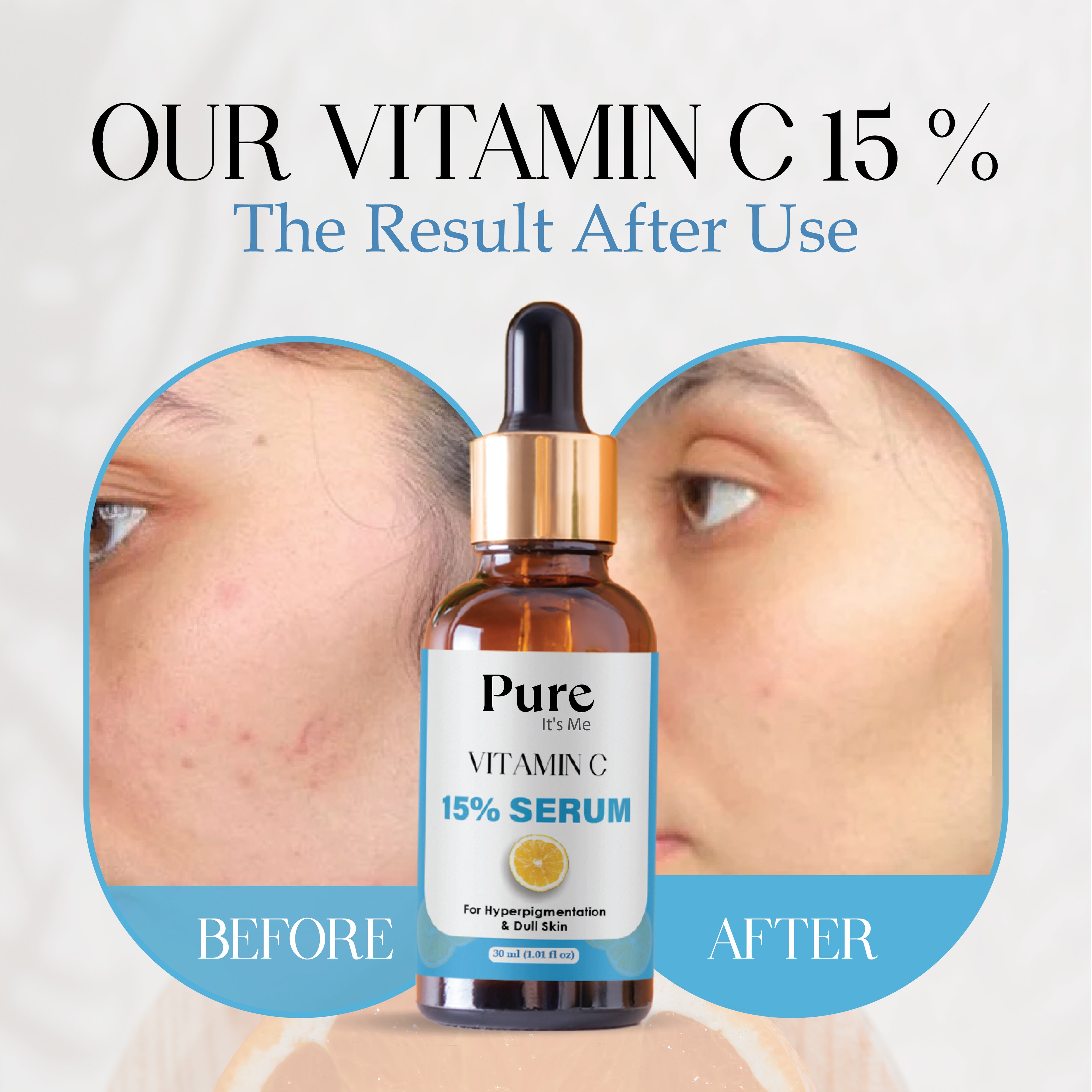 PUREITS VITAMIN C FACE SERUM