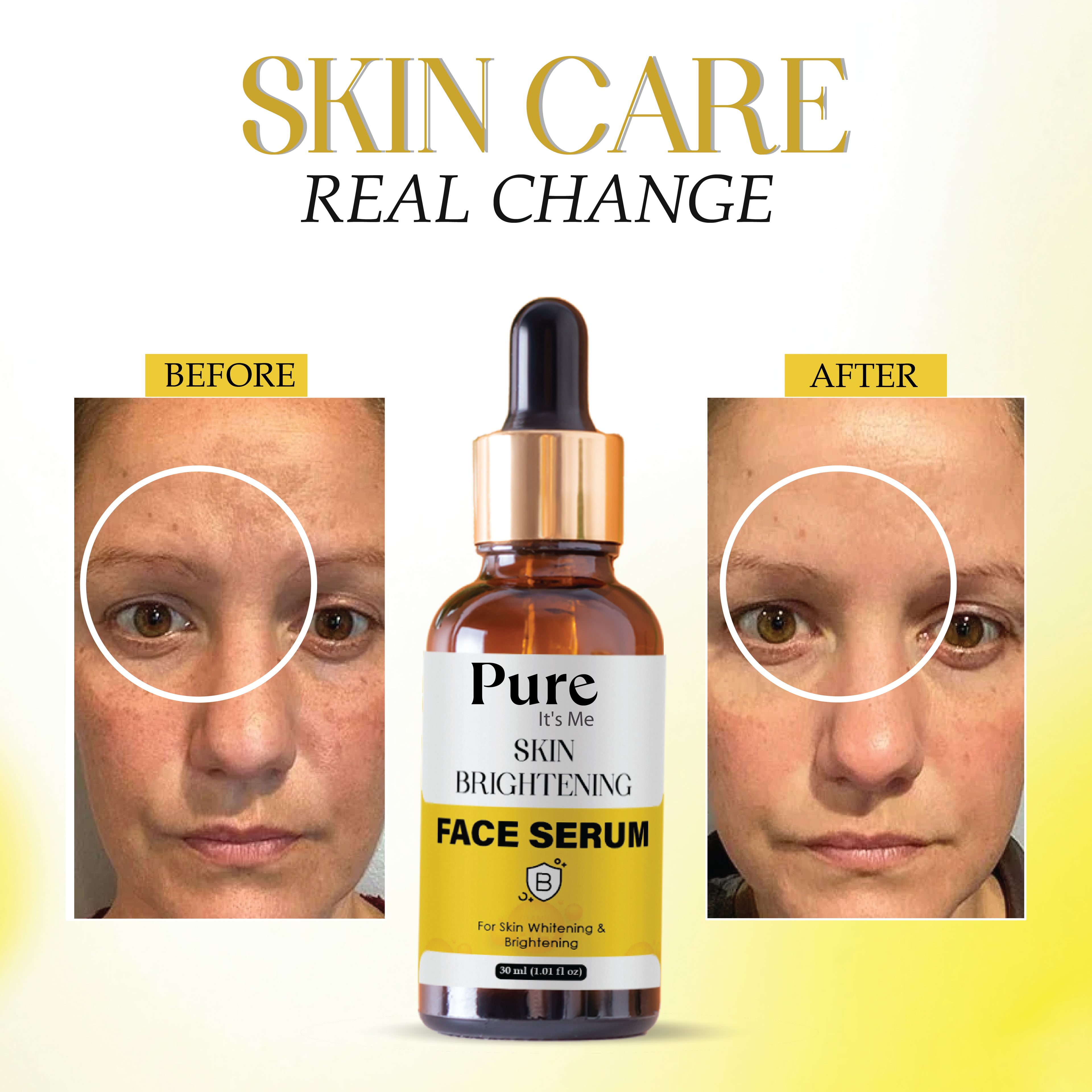 PUREITS SKIN BRIGHTENING